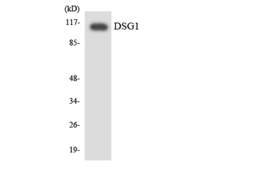 Western Blot - Anti-DSG1 Antibody (R12-2715) - Antibodies.com