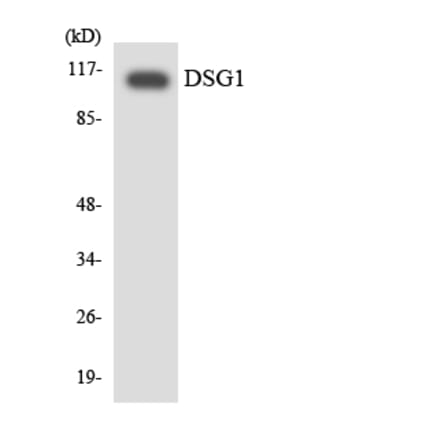 Western Blot - Anti-DSG1 Antibody (R12-2715) - Antibodies.com
