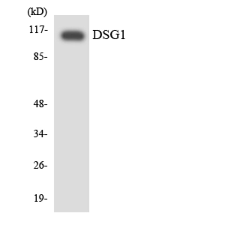 Western Blot - Anti-DSG1 Antibody (R12-2715) - Antibodies.com