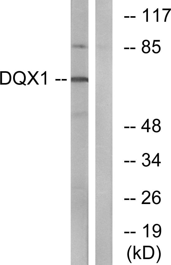 Western blot analysis of lysates from COS7 cells using Anti-DQX1 Antibody. The right hand lane represents a negative control, where the antibody is blocked by the immunising peptide.