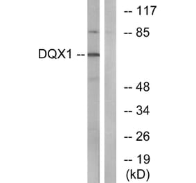 Western Blot - Anti-DQX1 Antibody (C14660) - Antibodies.com