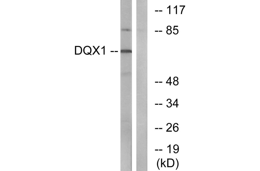 Western Blot - Anti-DQX1 Antibody (C14660) - Antibodies.com