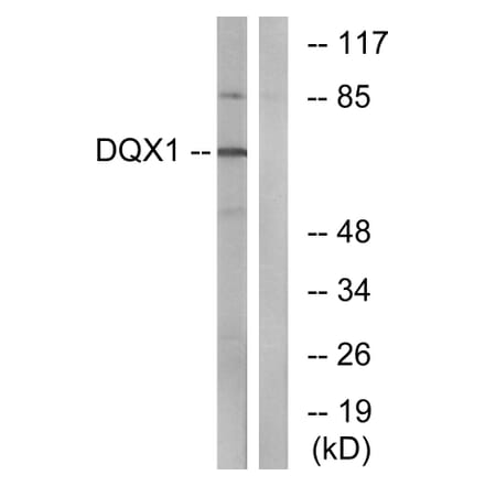 Western Blot - Anti-DQX1 Antibody (C14660) - Antibodies.com