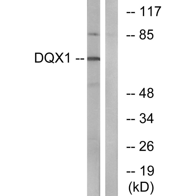 Western Blot - Anti-DQX1 Antibody (C14660) - Antibodies.com