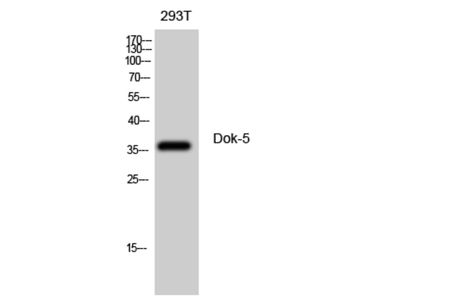 Western Blot - Anti-DOK5 Antibody (C11799) - Antibodies.com