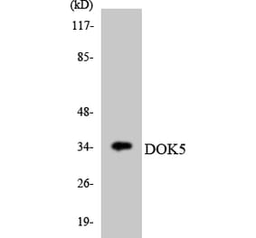 Western Blot - Anti-DOK5 Antibody (R12-2711) - Antibodies.com