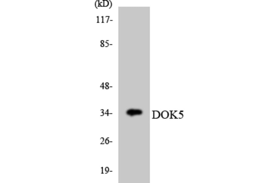 Western Blot - Anti-DOK5 Antibody (R12-2711) - Antibodies.com
