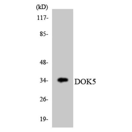 Western Blot - Anti-DOK5 Antibody (R12-2711) - Antibodies.com