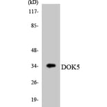 Western Blot - Anti-DOK5 Antibody (R12-2711) - Antibodies.com