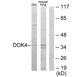 Western Blot - Anti-DOK4 Antibody (C11398) - Antibodies.com