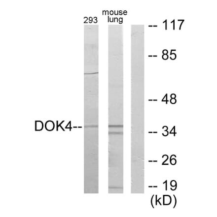 Western Blot - Anti-DOK4 Antibody (C11398) - Antibodies.com