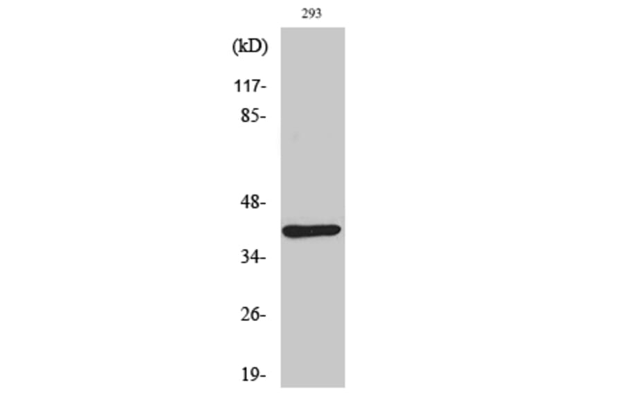 Western Blot - Anti-DOK4 Antibody (C11398) - Antibodies.com