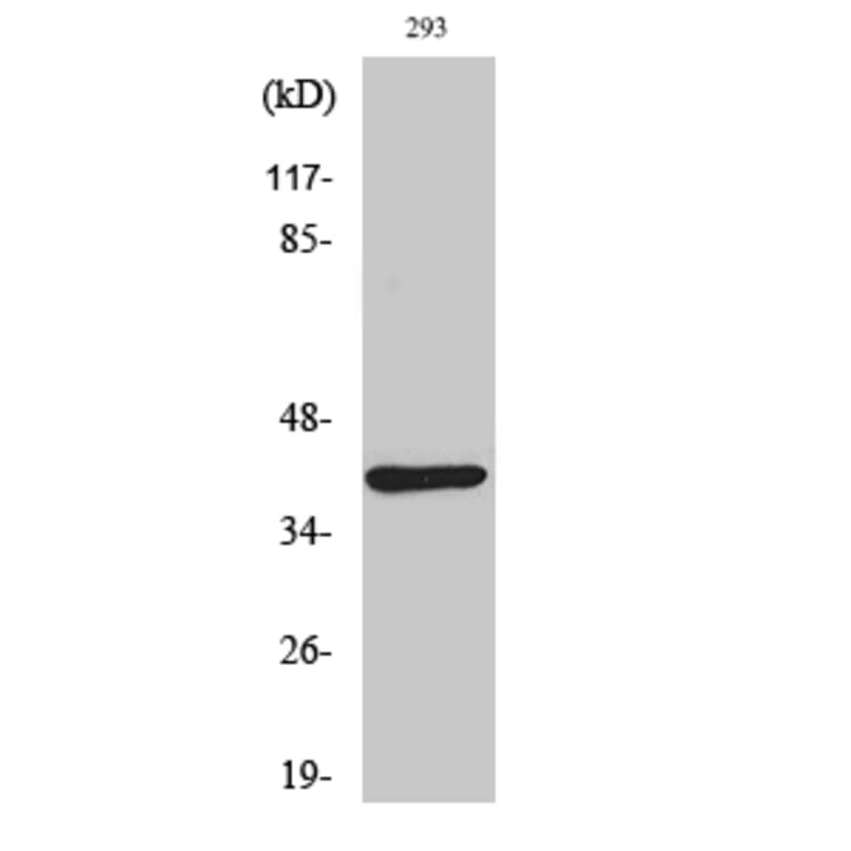 Western Blot - Anti-DOK4 Antibody (C11398) - Antibodies.com