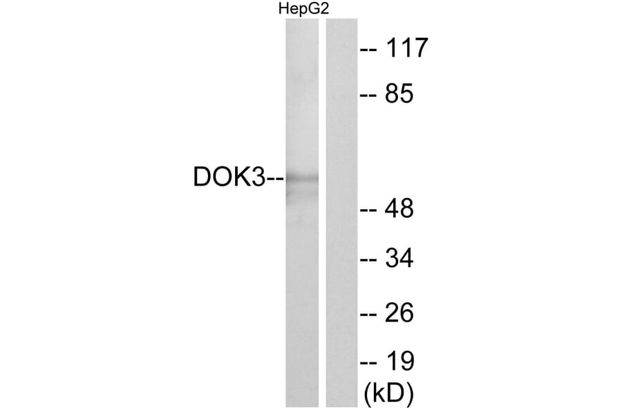 Western Blot - Anti-DOK3 Antibody (C11252) - Antibodies.com