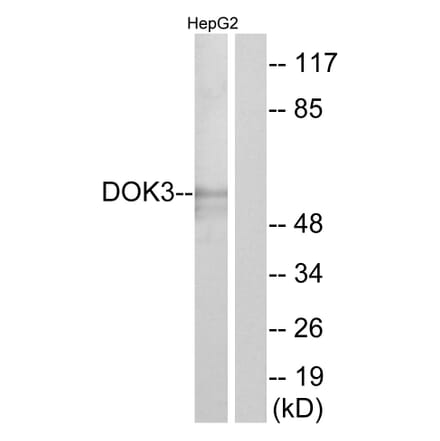 Western Blot - Anti-DOK3 Antibody (C11252) - Antibodies.com
