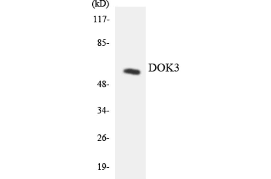 Western Blot - Anti-DOK3 Antibody (R12-2710) - Antibodies.com