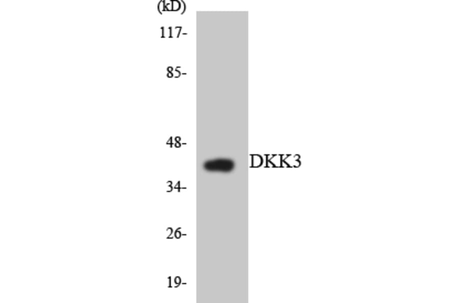 Western Blot - Anti-DKK3 Antibody (R12-2700) - Antibodies.com