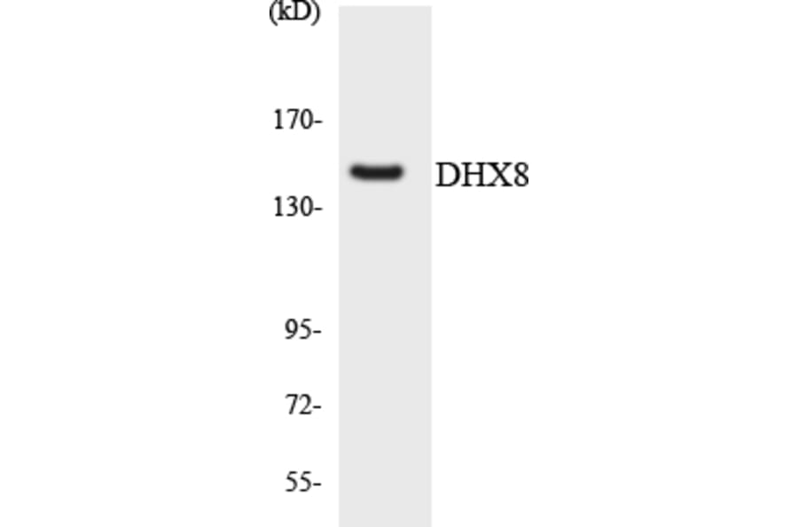 Western Blot - Anti-DHX8 Antibody (R12-2698) - Antibodies.com