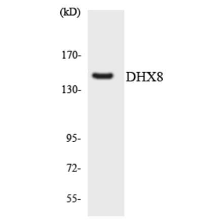 Western Blot - Anti-DHX8 Antibody (R12-2698) - Antibodies.com