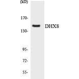 Western Blot - Anti-DHX8 Antibody (R12-2698) - Antibodies.com