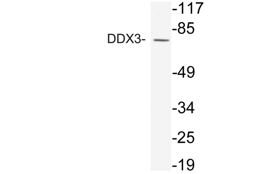 Western Blot - Anti-DDX3 Antibody (R12-2111) - Antibodies.com