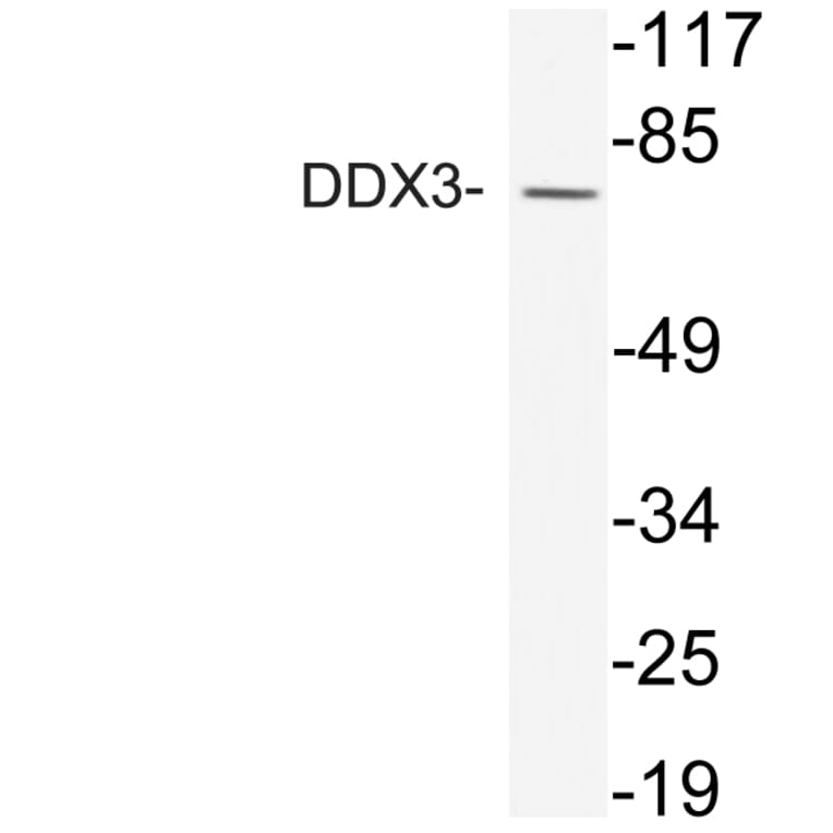 Western Blot - Anti-DDX3 Antibody (R12-2111) - Antibodies.com