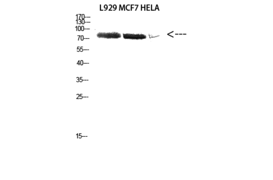 Western Blot - Anti-DDX3 Antibody (R12-2111) - Antibodies.com