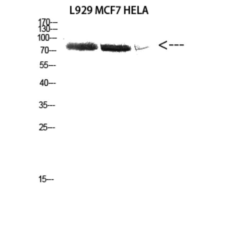 Western Blot - Anti-DDX3 Antibody (R12-2111) - Antibodies.com