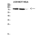 Western Blot - Anti-DDX3 Antibody (R12-2111) - Antibodies.com
