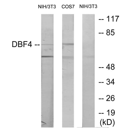 Western Blot - Anti-DBF4 Antibody (C11821) - Antibodies.com