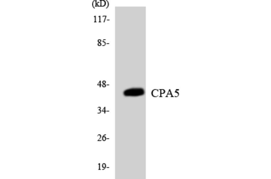 Western Blot - Anti-CPA5 Antibody (R12-2646) - Antibodies.com