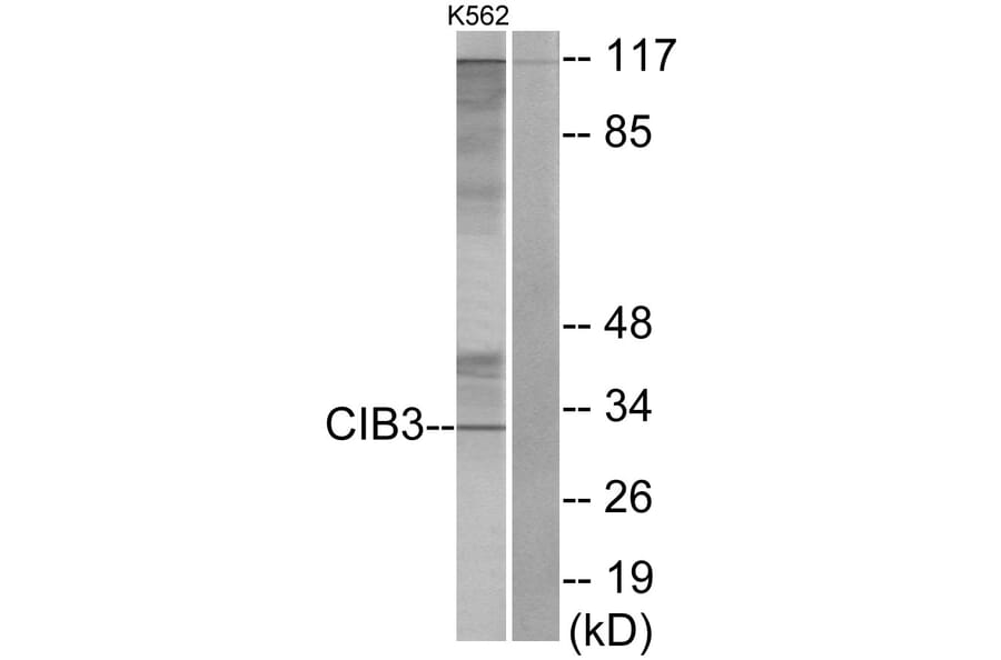 Western Blot - Anti-CIB3 Antibody (C11530) - Antibodies.com
