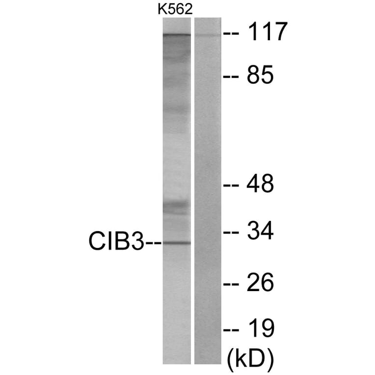 Western Blot - Anti-CIB3 Antibody (C11530) - Antibodies.com