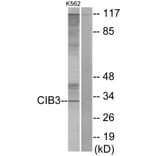 Western Blot - Anti-CIB3 Antibody (C11530) - Antibodies.com
