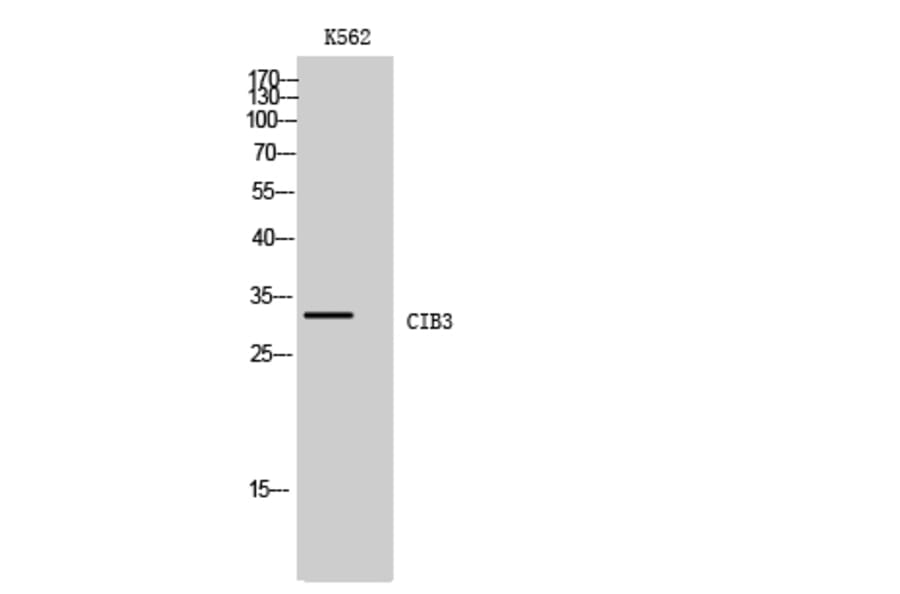 Western Blot - Anti-CIB3 Antibody (C11530) - Antibodies.com