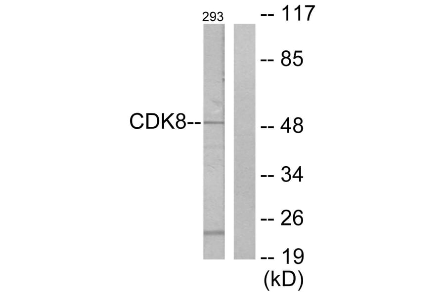 Western Blot - Anti-CDK8 Antibody (C10643) - Antibodies.com