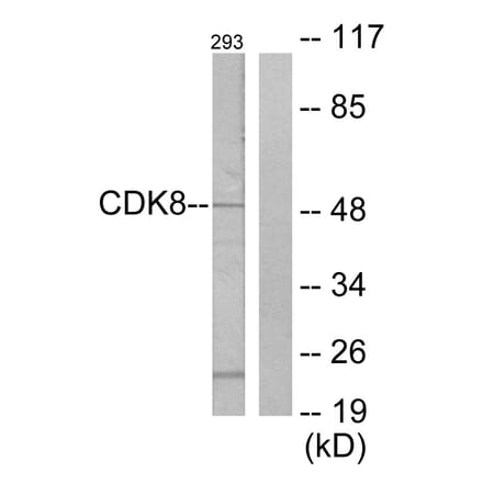 Western Blot - Anti-CDK8 Antibody (C10643) - Antibodies.com