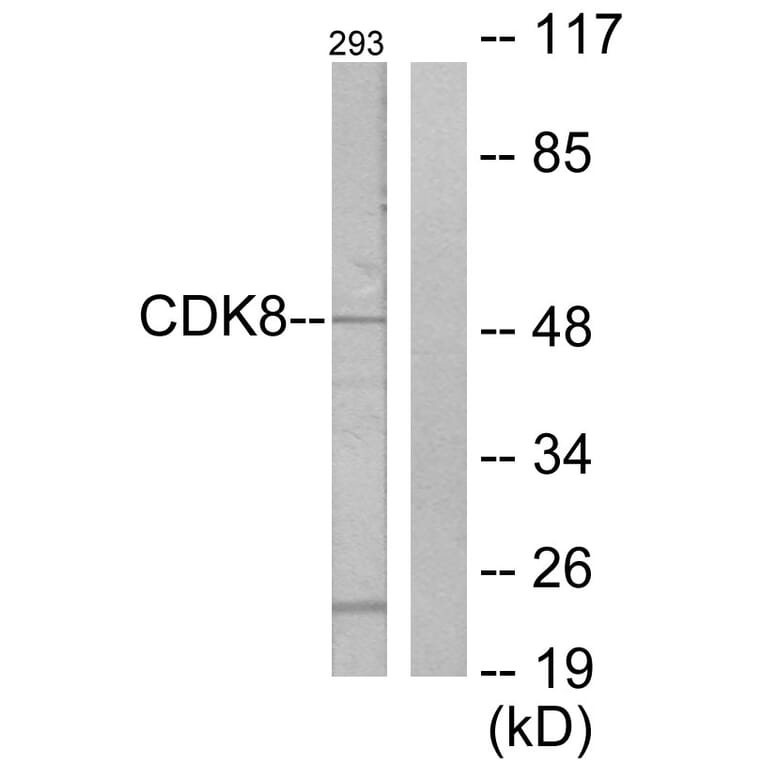 Western Blot - Anti-CDK8 Antibody (C10643) - Antibodies.com