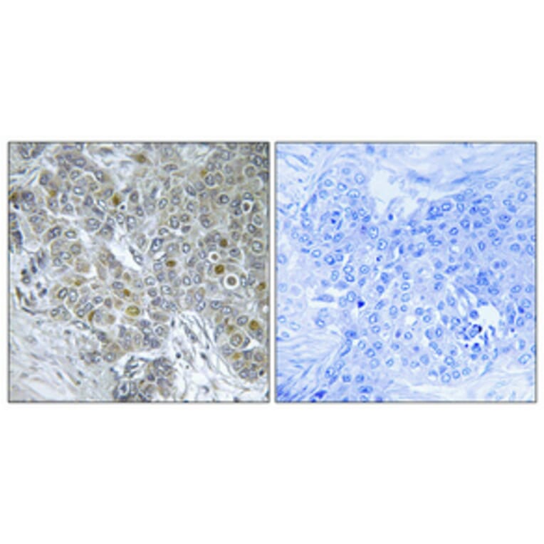 Immunohistochemistry - Anti-CDK8 Antibody (C10643) - Antibodies.com