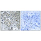 Immunohistochemistry - Anti-CDK8 Antibody (C10643) - Antibodies.com