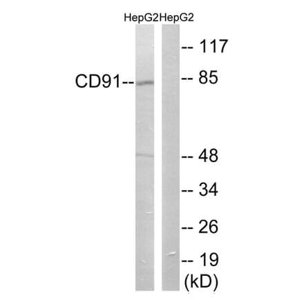 Western Blot - Anti-CD91 Antibody (B8225) - Antibodies.com