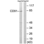 Western Blot - Anti-CD91 Antibody (B8225) - Antibodies.com