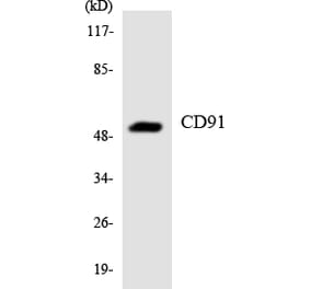 Western Blot - Anti-CD91 Antibody (R12-2594) - Antibodies.com