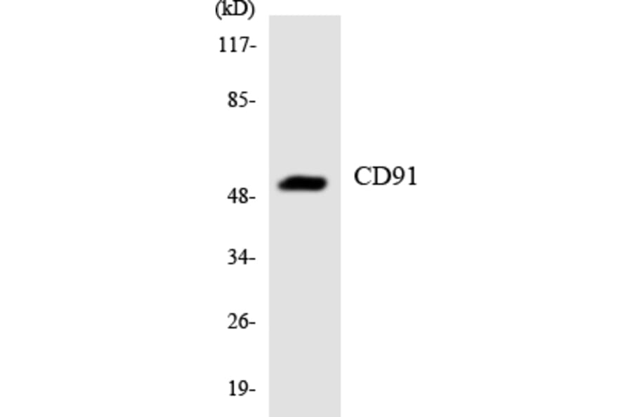 Western Blot - Anti-CD91 Antibody (R12-2594) - Antibodies.com