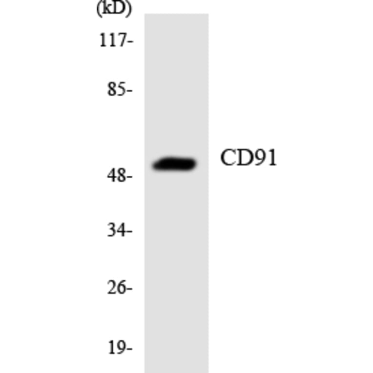 Western Blot - Anti-CD91 Antibody (R12-2594) - Antibodies.com