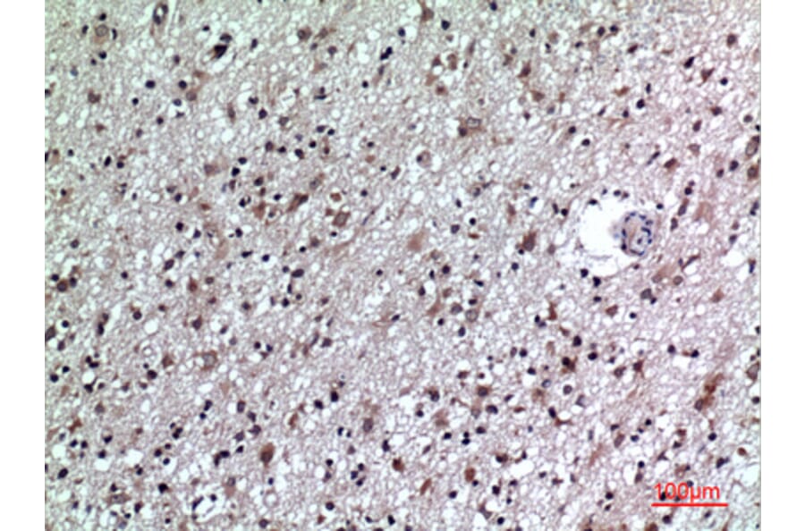 Immunohistochemistry - Anti-CD84 Antibody (C30386) - Antibodies.com