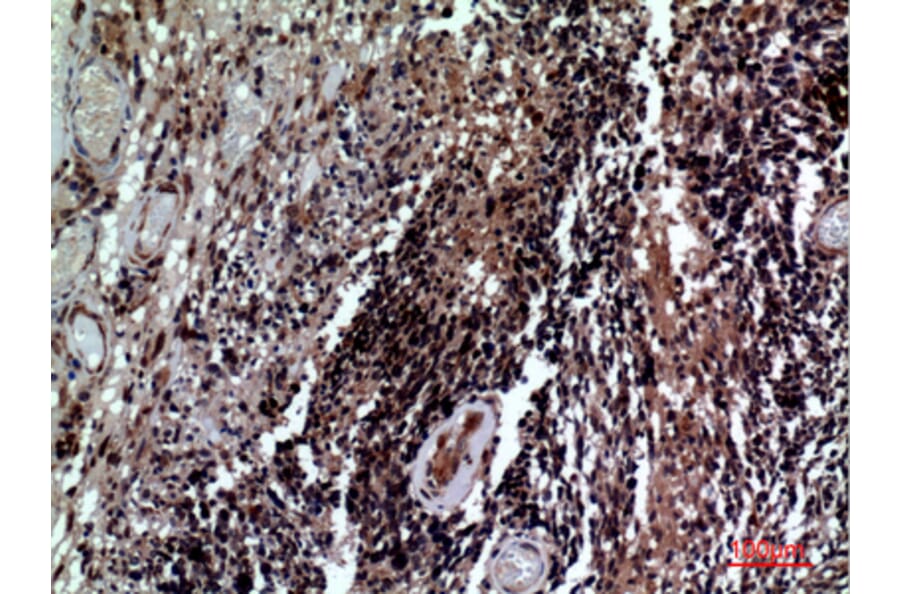 Immunohistochemistry - Anti-CD84 Antibody (C30386) - Antibodies.com