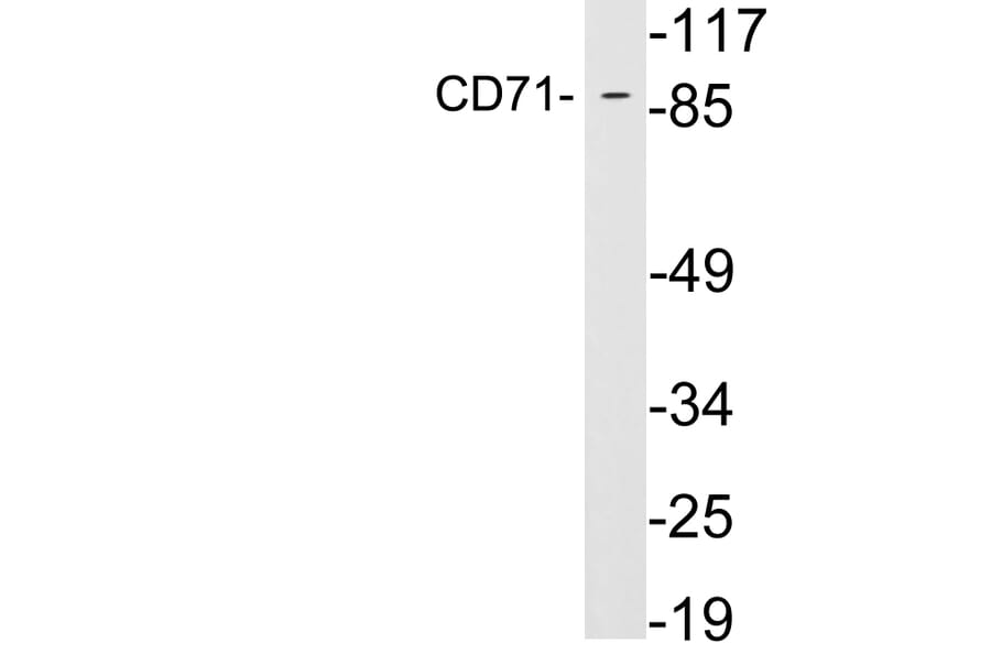 Western Blot - Anti-CD71 Antibody (R12-2082) - Antibodies.com