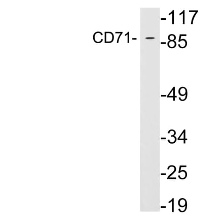 Western Blot - Anti-CD71 Antibody (R12-2082) - Antibodies.com