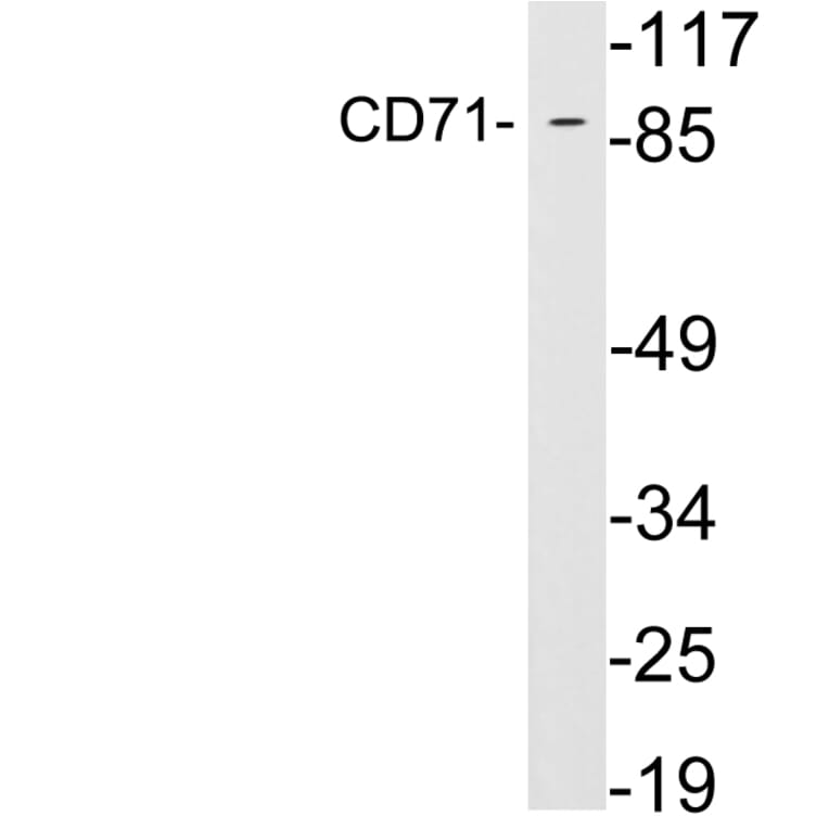 Western Blot - Anti-CD71 Antibody (R12-2082) - Antibodies.com